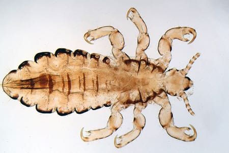 Head louse under a microscope
